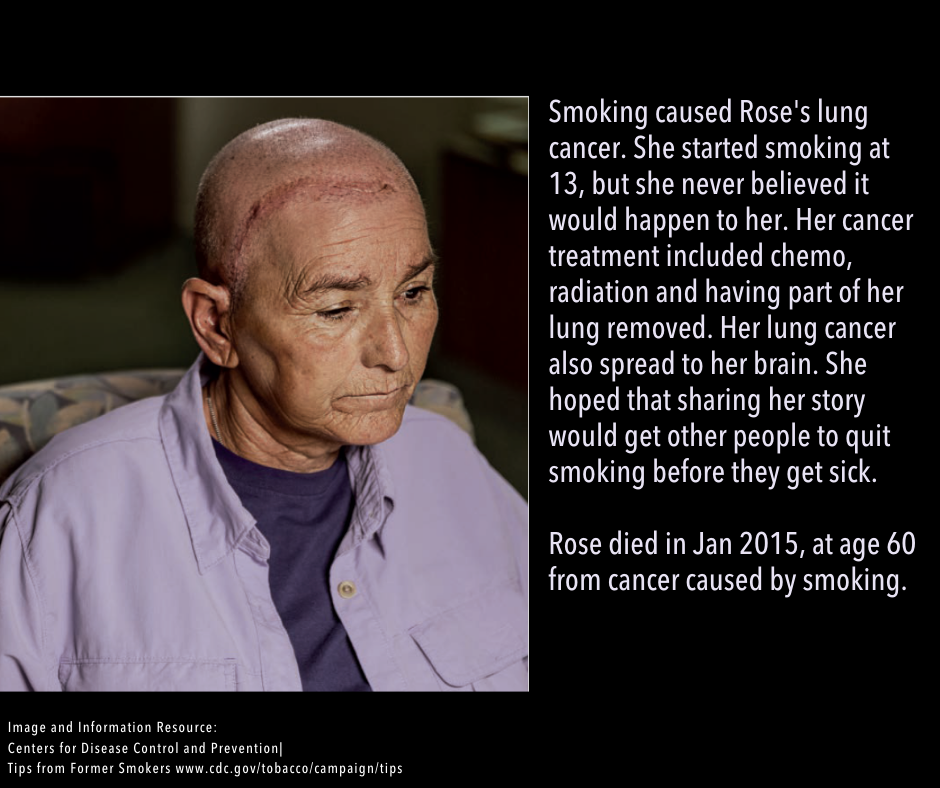 Picture of a lung cancer survivor and the following text: Smoking caused Rose's lung cancer. She started smoking at 13, but she never believed it would happen to her. Her cancer treatment included chemo, radiation and having part of her lung removed. Her lung cancer also spread to her brain. She hoped that sharing her story would get other people to quit smoking before they get sick.   Rose died in Jan 2015, at age 60 from cancer caused by smoking